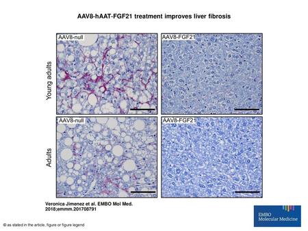AAV8‐hAAT‐FGF21 treatment improves liver fibrosis