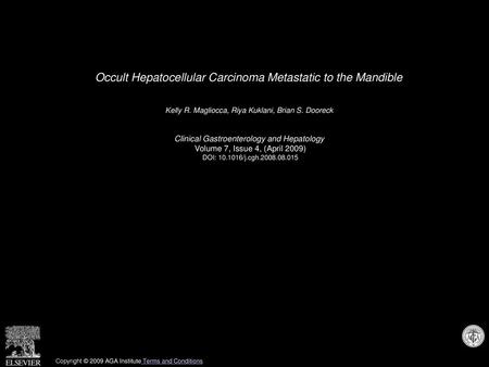 Occult Hepatocellular Carcinoma Metastatic to the Mandible