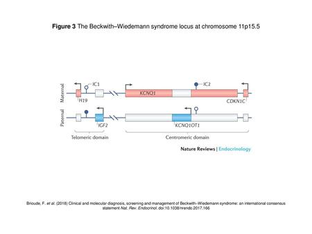 Figure 3 The Beckwith–Wiedemann syndrome locus at chromosome 11p15.5