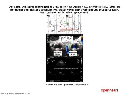 Ao, aorta; AR, aortic regurgitation; CFD, color-flow Doppler; LV, left ventricle; LV EDP, left ventricular end-diastolic pressure; PW, pulse-wave; SBP,