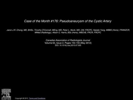 Case of the Month #176: Pseudoaneurysm of the Cystic Artery