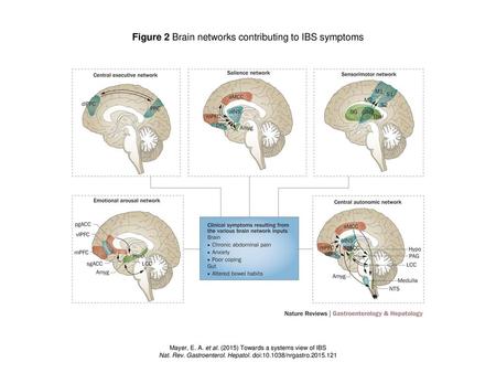 Figure 2 Brain networks contributing to IBS symptoms