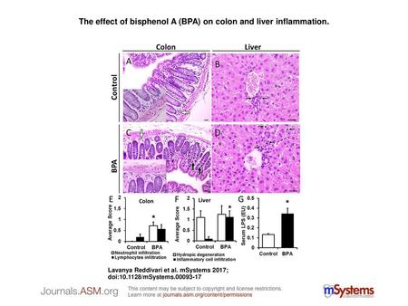 The effect of bisphenol A (BPA) on colon and liver inflammation.