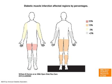 Diabetic muscle infarction affected regions by percentages.