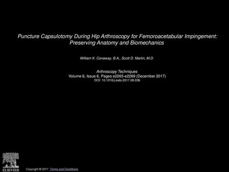 Puncture Capsulotomy During Hip Arthroscopy for Femoroacetabular Impingement: Preserving Anatomy and Biomechanics  William K. Conaway, B.A., Scott D.