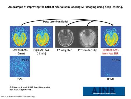 An example of improving the SNR of arterial spin-labeling MR imaging using deep learning. An example of improving the SNR of arterial spin-labeling MR.