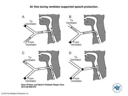 Air flow during ventilator-supported speech production.