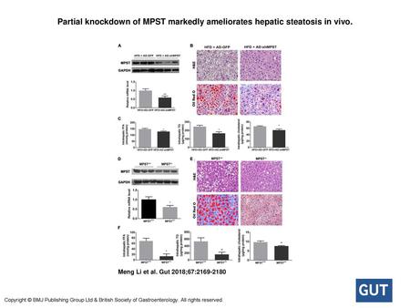 Partial knockdown of MPST markedly ameliorates hepatic steatosis in vivo. Partial knockdown of MPST markedly ameliorates hepatic steatosis in vivo. (A–C)