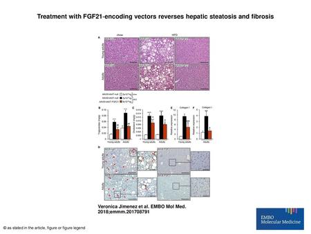 Treatment with FGF21‐encoding vectors reverses hepatic steatosis and fibrosis Treatment with FGF21‐encoding vectors reverses hepatic steatosis and fibrosis.