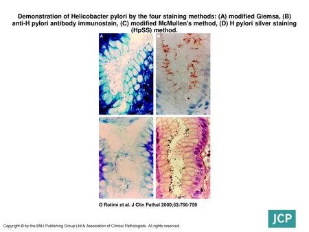 Demonstration of Helicobacter pylori by the four staining methods: (A) modified Giemsa, (B) anti-H pylori antibody immunostain, (C) modified McMullen's.