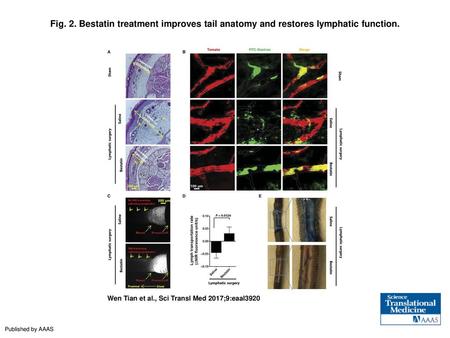 Fig. 2. Bestatin treatment improves tail anatomy and restores lymphatic function. Bestatin treatment improves tail anatomy and restores lymphatic function.
