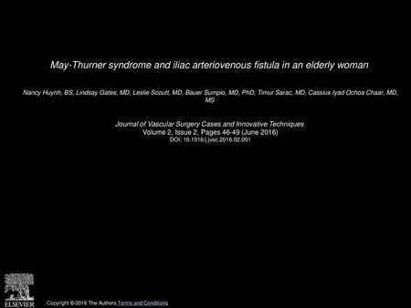 May-Thurner syndrome and iliac arteriovenous fistula in an elderly woman  Nancy Huynh, BS, Lindsay Gates, MD, Leslie Scoutt, MD, Bauer Sumpio, MD, PhD,