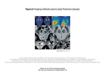 Figure 6 Imaging methods used to study Parkinson disease