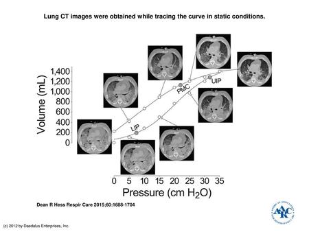 Lung CT images were obtained while tracing the curve in static conditions. Lung CT images were obtained while tracing the curve in static conditions. Note.
