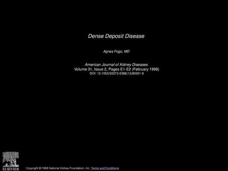 Dense Deposit Disease American Journal of Kidney Diseases