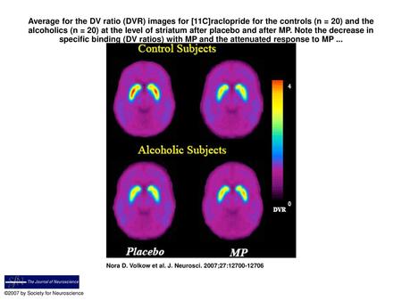 Average for the DV ratio (DVR) images for [11C]raclopride for the controls (n = 20) and the alcoholics (n = 20) at the level of striatum after placebo.