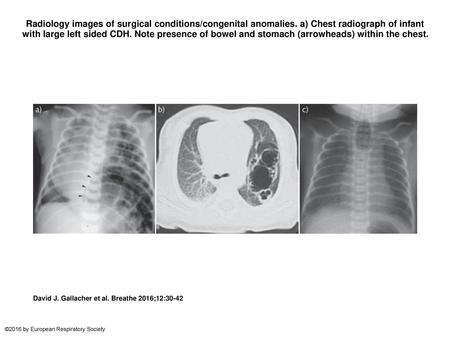 Radiology images of surgical conditions/congenital anomalies