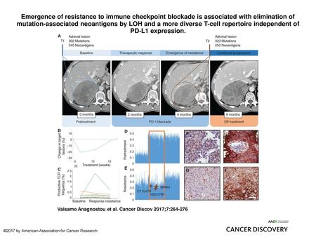 Emergence of resistance to immune checkpoint blockade is associated with elimination of mutation-associated neoantigens by LOH and a more diverse T-cell.