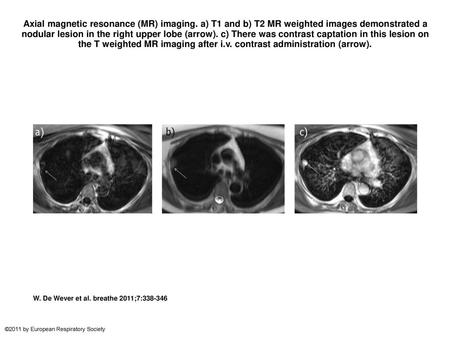 Axial magnetic resonance (MR) imaging