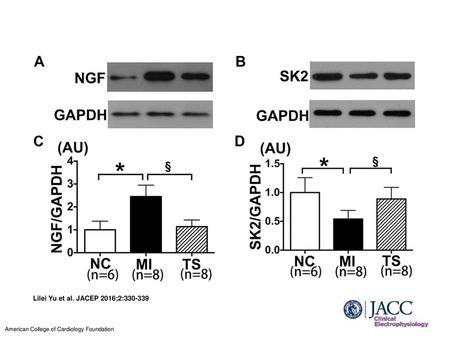 Representative Examples of NGF and SK2 Protein Expression Within LSG A and B show representative Western blot images of NGF and SK2; C and D show corresponding.
