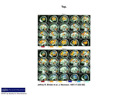 Top. Top. FMRI activation map for the tone decision–rest comparison. The data are presented as sequential sagittal sections from left to right, with the.