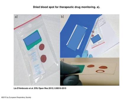 Dried blood spot for therapeutic drug monitoring. a).