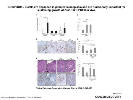 CD1dhiCD5+ B cells are expanded in pancreatic neoplasia and are functionally important for sustaining growth of KrasG12D-PDEC in vivo. CD1dhiCD5+ B cells.
