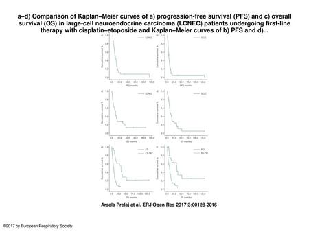 A–d) Comparison of Kaplan–Meier curves of a) progression-free survival (PFS) and c) overall survival (OS) in large-cell neuroendocrine carcinoma (LCNEC)