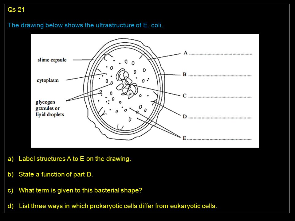 Qs 21 The Drawing Below Shows The Ultrastructure Of E Coli Ppt Video Online Download Qs 21 The Drawing Below Shows The Ultrastructure Of E Coli Ppt Video Online Download