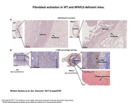 Fibroblast activation in WT and NFATc2-deficient mice.