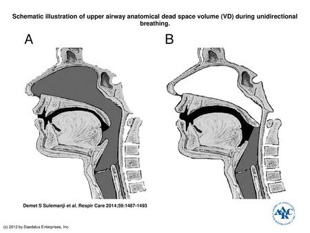 Schematic illustration of upper airway anatomical dead space volume (VD) during unidirectional breathing. Schematic illustration of upper airway anatomical.