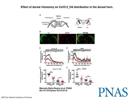 Effect of dorsal rhizotomy on CaV2