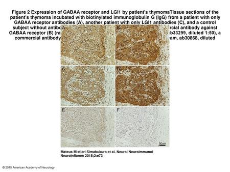 Figure 2 Expression of GABAA receptor and LGI1 by patient's thymomaTissue sections of the patient's thymoma incubated with biotinylated immunoglobulin.