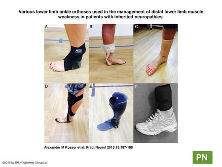 Various lower limb ankle orthoses used in the management of distal lower limb muscle weakness in patients with inherited neuropathies. Various lower limb.
