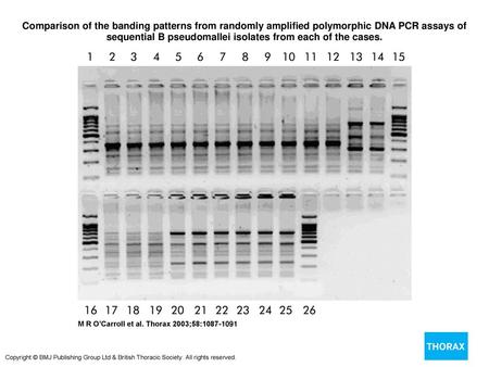 Comparison of the banding patterns from randomly amplified polymorphic DNA PCR assays of sequential B pseudomallei isolates from each of the cases. Comparison.