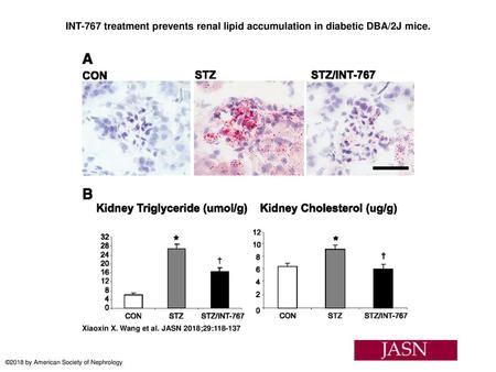 INT-767 treatment prevents renal lipid accumulation in diabetic DBA/2J mice. INT-767 treatment prevents renal lipid accumulation in diabetic DBA/2J mice.