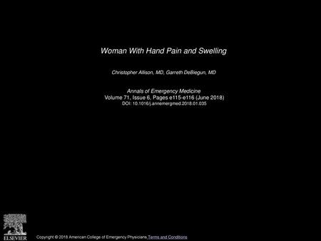 Woman With Hand Pain and Swelling