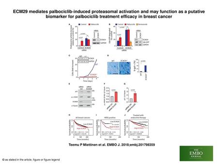 ECM29 mediates palbociclib‐induced proteasomal activation and may function as a putative biomarker for palbociclib treatment efficacy in breast cancer.