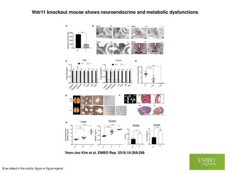 Wdr11 knockout mouse shows neuroendocrine and metabolic dysfunctions