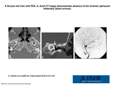 A 30-year-old man with PSA