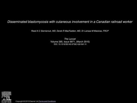 Disseminated blastomycosis with cutaneous involvement in a Canadian railroad worker  Reed A C Siemieniuk, MD, Derek R MacFadden, MD, Dr Larissa M Matukas,