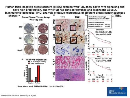 Human triple‐negative breast cancers (TNBC) express WNT10B, show active Wnt signalling and have high proliferation, and WNT10B has clinical relevance and.