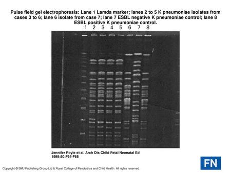 Pulse field gel electrophoresis: Lane 1 Lamda marker; lanes 2 to 5 K pneumoniae isolates from cases 3 to 6; lane 6 isolate from case 7; lane 7 ESBL negative.