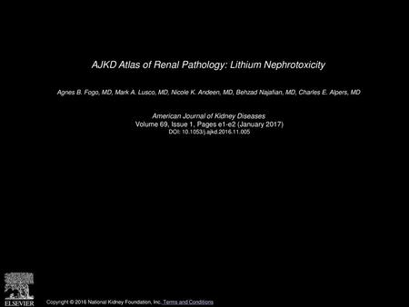 AJKD Atlas of Renal Pathology: Lithium Nephrotoxicity