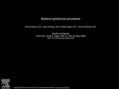 Bilateral epididymal sarcoidosis