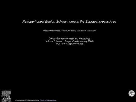 Retroperitoneal Benign Schwannoma in the Suprapancreatic Area