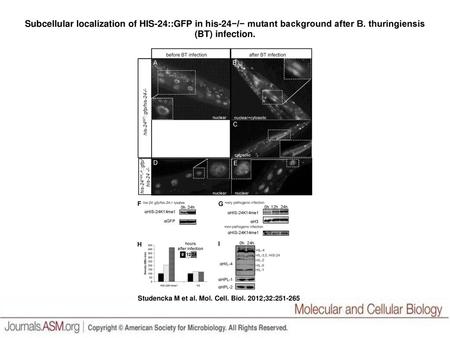 Subcellular localization of HIS-24::GFP in his-24−/− mutant background after B. thuringiensis (BT) infection. Subcellular localization of HIS-24::GFP in.
