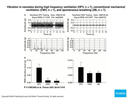 Vibration in neonates during high frequency ventilation (HFV, n = 7), conventional mechanical ventilation (CMV, n = 7), and spontaneous breathing (SB,