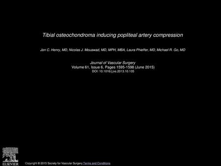 Tibial osteochondroma inducing popliteal artery compression