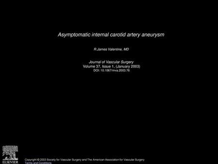 Asymptomatic internal carotid artery aneurysm